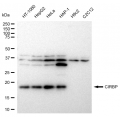 KD-Validated CIRBP Rabbit mAb (20 μl)