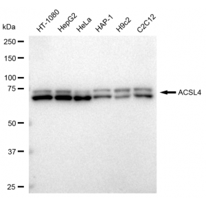 KD-Validated ACSL4 Rabbit mAb (20 μl)