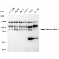KD-Validated CTNND1 Rabbit mAb (20 μl)