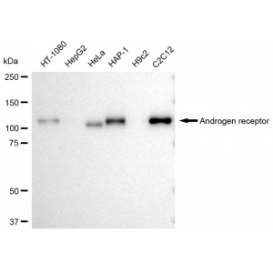 KD-Validated AR Rabbit mAb (20 μl)