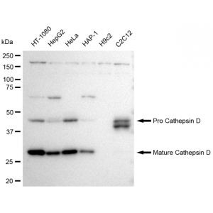 KD-Validated CTSD Rabbit mAb (20 μl)