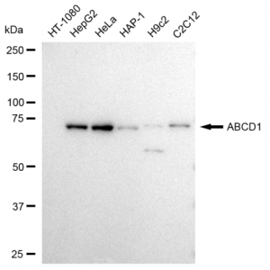 KD-Validated ABCD1 Rabbit mAb (20 μl)