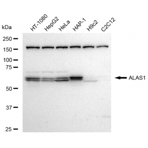 KD-Validated ALAS1 Rabbit mAb (20 μl)
