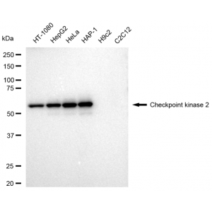 KD-Validated CHEK2 Rabbit mAb (20 μl)