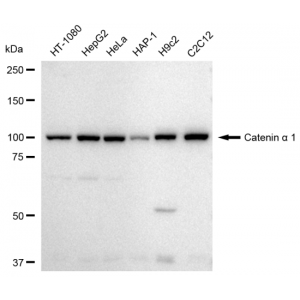 KD-Validated CTNNA1 Rabbit mAb (20 μl)