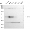 KD-Validated CD99 Rabbit mAb (20 μl)