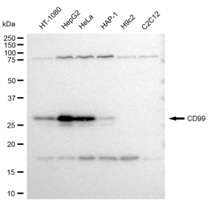 KD-Validated CD99 Rabbit mAb (20 μl)