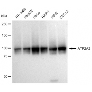 KD-Validated ATP2A2 Rabbit mAb (20 μl)