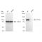 KD-Validated ATP2A2 Rabbit mAb (20 μl)