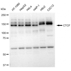 KD-Validated CTCF Rabbit mAb (20 μl)
