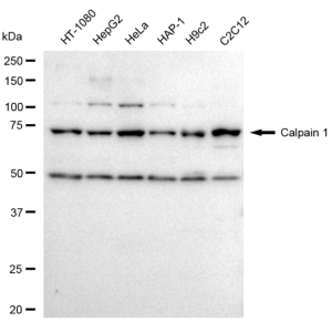 KD-Validated CAPN1 Rabbit mAb (20 μl)