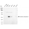 KD-Validated CA2 Rabbit mAb (20 μl)
