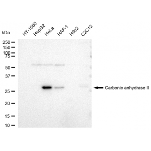 KD-Validated CA2 Rabbit mAb (20 μl)