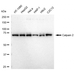KD-Validated CAPN2 Rabbit mAb (20 μl)