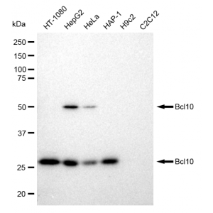 KD-Validated BCL10 Rabbit mAb (20 μl)