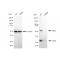 KD-Validated BCL10 Rabbit mAb (20 μl)
