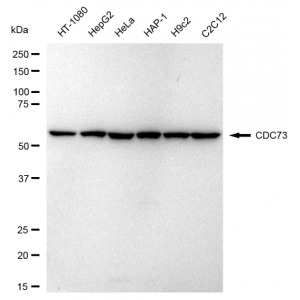 KD-Validated CDC73 Rabbit mAb (20 μl)