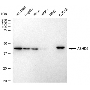 KD-Validated ABHD5 Rabbit mAb (20 μl)