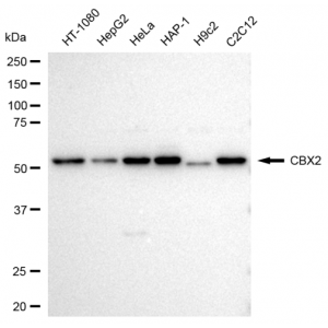 KD-Validated CBX2 Rabbit mAb (20 μl)