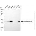 KD-Validated HDAC8 Rabbit mAb (20 μl)