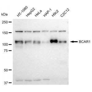 KD-Validated BCAR1 Rabbit mAb (20 μl)