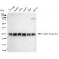 KD-Validated CSNK2B Rabbit mAb (20 μl)