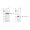 KD-Validated CSNK2B Rabbit mAb (20 μl)