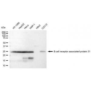 KD-Validated BCAP31 Rabbit mAb (20 μl)