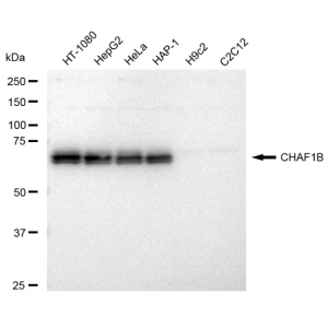 KD-Validated CHAF1B Rabbit mAb (20 μl)