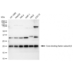 KD-Validated CBFB Rabbit mAb (20 μl)