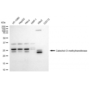 KD-Validated COMT Rabbit mAb (20 μl)