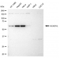 KD-Validated ACADVL Rabbit mAb (20 μl)