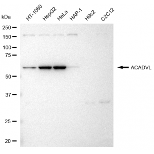 KD-Validated ACADVL Rabbit mAb (20 μl)