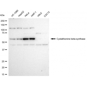 KD-Validated CBS Rabbit mAb (20 μl)