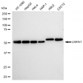KD-Validated LMAN1 Rabbit mAb (20 μl)