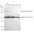 KD-Validated LOXL2 Rabbit mAb (20 μl)