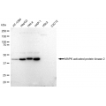 KD-Validated MAPKAPK2 Rabbit mAb (20 μl)