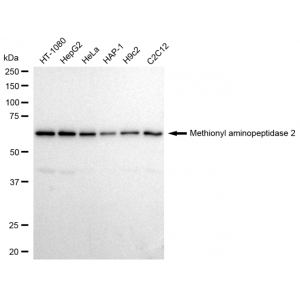 KD-Validated METAP2 Rabbit mAb (20 μl)