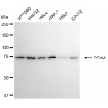 KD-Validated PFKM Rabbit mAb (20 μl)