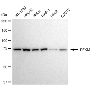 KD-Validated PFKM Rabbit mAb (20 μl)