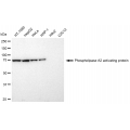 KD-Validated PLAA Rabbit mAb (20 μl)