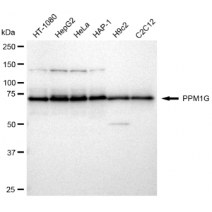 KD-Validated PPM1G Rabbit mAb (20 μl)