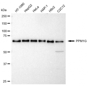 KD-Validated PPM1G Rabbit mAb (20 μl)