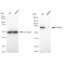 KD-Validated PPM1G Rabbit mAb (20 μl)