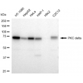 KD-Validated PRKCD Rabbit mAb (20 μl)