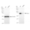 KD-Validated PRKCD Rabbit mAb (20 μl)