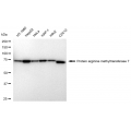 KD-Validated PRMT7 Rabbit mAb (20 μl)