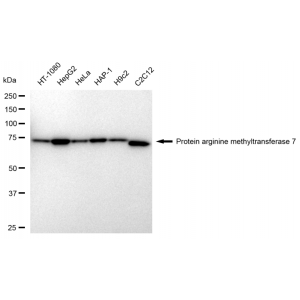 KD-Validated PRMT7 Rabbit mAb (20 μl)