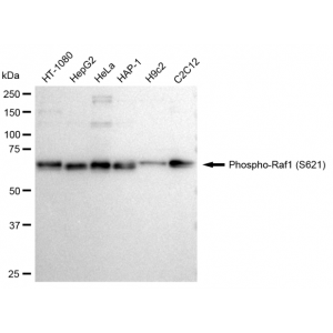KD-Validated Phospho-Raf1 (S621) Rabbit mAb (20 μl)