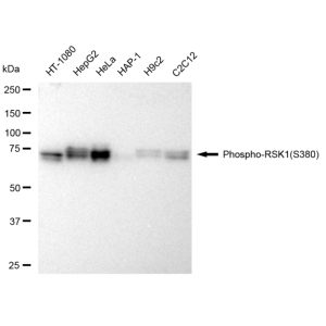 KD-Validated Phospho-RSK1 (S380) Rabbit mAb (20 μl)